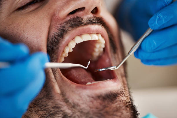 Best Emergency Root Canal Treatment in Raymondville, TX